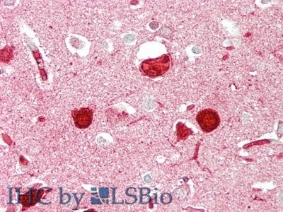 Polyclonal Antibody to ATP Binding Cassette Transporter G1 (ABCG1)