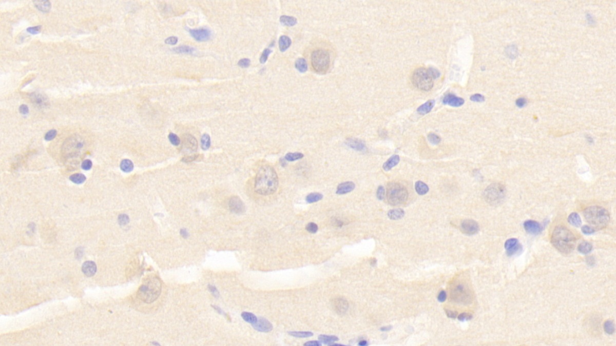 Polyclonal Antibody to Protein Tyrosine Phosphatase Receptor Type S (PTPRS)