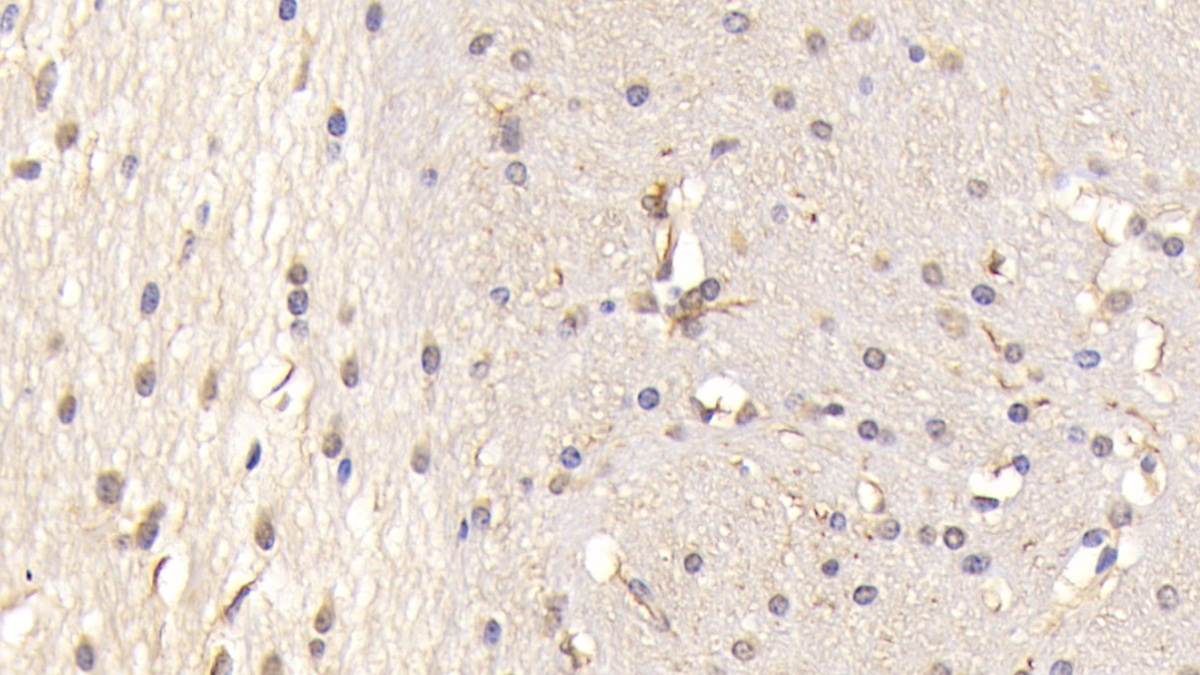 Polyclonal Antibody to Protein Tyrosine Phosphatase Receptor Type S (PTPRS)