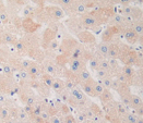 Polyclonal Antibody to Dopamine Receptor D1 (DRD1)