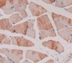 Polyclonal Antibody to Agouti Related Protein (AGRP)