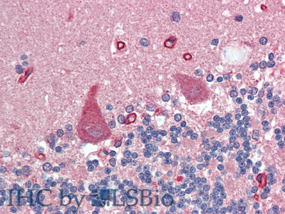 Polyclonal Antibody to Agrin (AGRN)