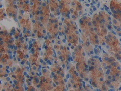 Polyclonal Antibody to Agrin (AGRN)