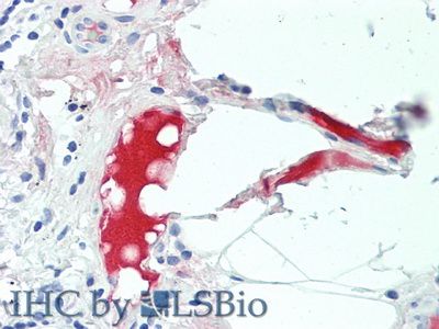 Polyclonal Antibody to Complement C4-B (C4B)