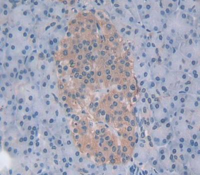 Polyclonal Antibody to Chymotrypsin C (CTRC)