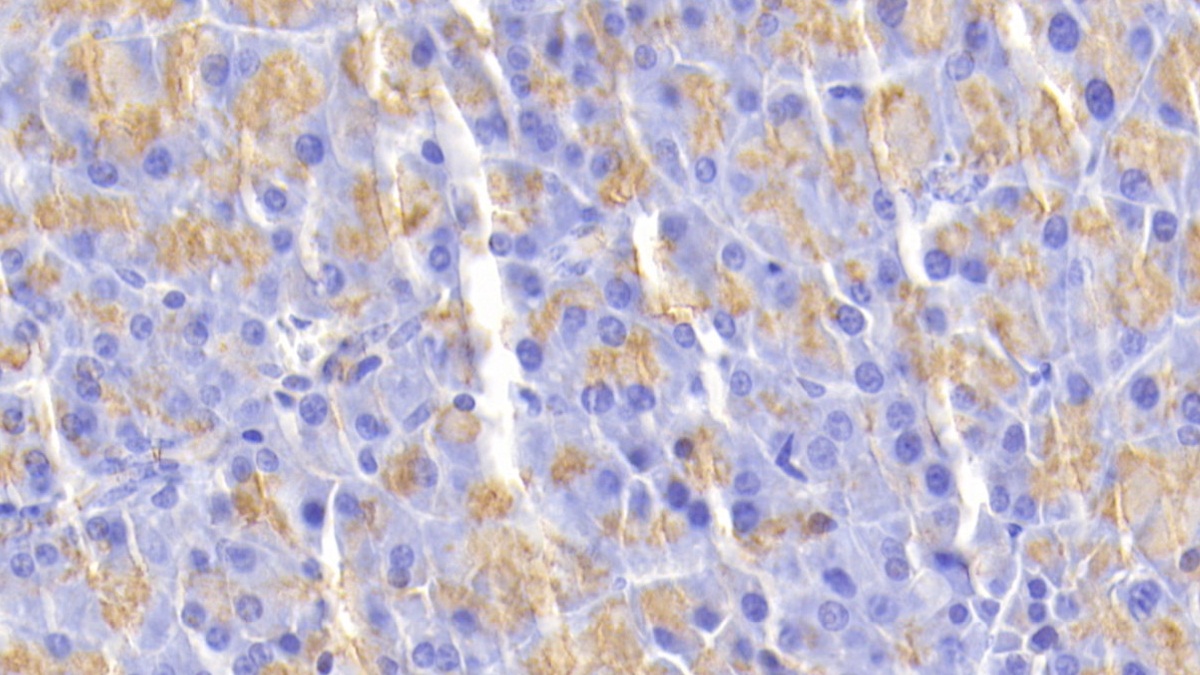 Polyclonal Antibody to Chymotrypsin C (CTRC)