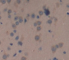 Polyclonal Antibody to Proopiomelanocortin (POMC)