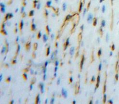 Polyclonal Antibody to Procollagen C-Endopeptidase Enhancer (PCOLCE)