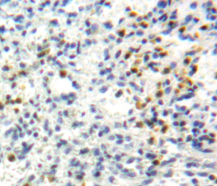 Polyclonal Antibody to Perforin 1 (PRF1)