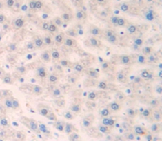 Polyclonal Antibody to Perforin 1 (PRF1)