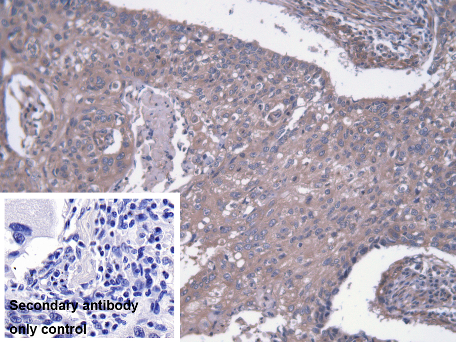 Polyclonal Antibody to Microtubule Associated Protein 4 (MAP4)