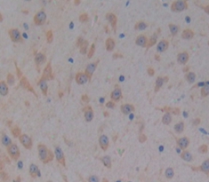 Polyclonal Antibody to Protein Tyrosine Kinase 2 Beta (PYK2)