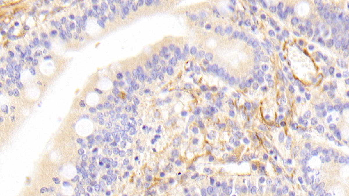 Polyclonal Antibody to Caldesmon (CALD)