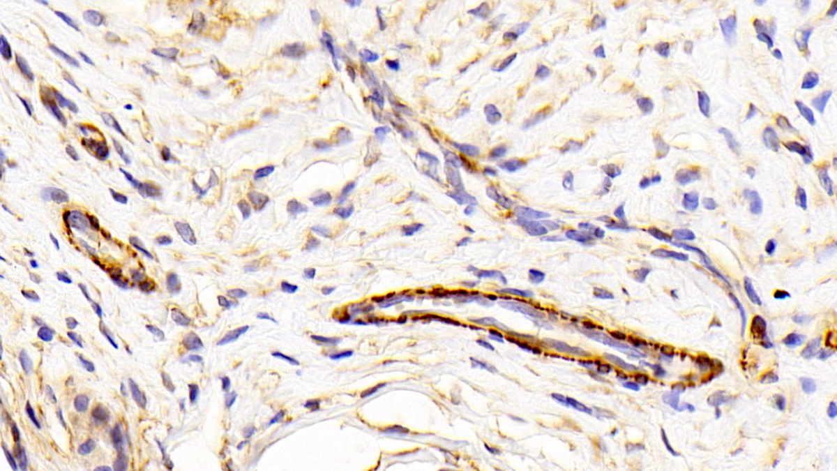 Polyclonal Antibody to Caldesmon (CALD)