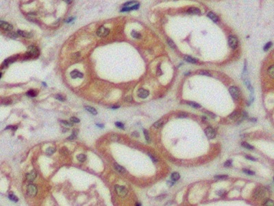 Polyclonal Antibody to Beta Actin (ACTB)