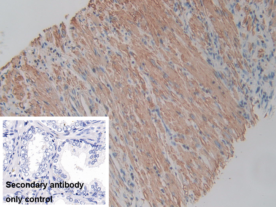 Polyclonal Antibody to Actin Gamma 2, Smooth Muscle (ACTg2)