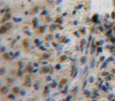 Polyclonal Antibody to Activating Transcription Factor 1 (ATF1)