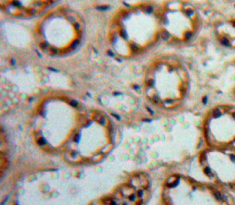 Polyclonal Antibody to Adenylate Cyclase 1, Brain (ADCY1)