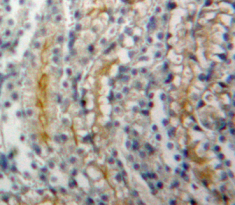 Polyclonal Antibody to Adenylate Cyclase 1, Brain (ADCY1)