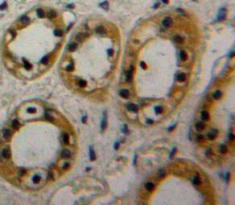 Polyclonal Antibody to Adenylyl Cyclase Associated Protein 1 (CAP1)