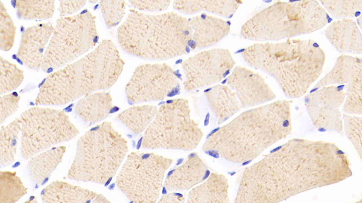 Polyclonal Antibody to 5-Lipoxygenase (5-LO)