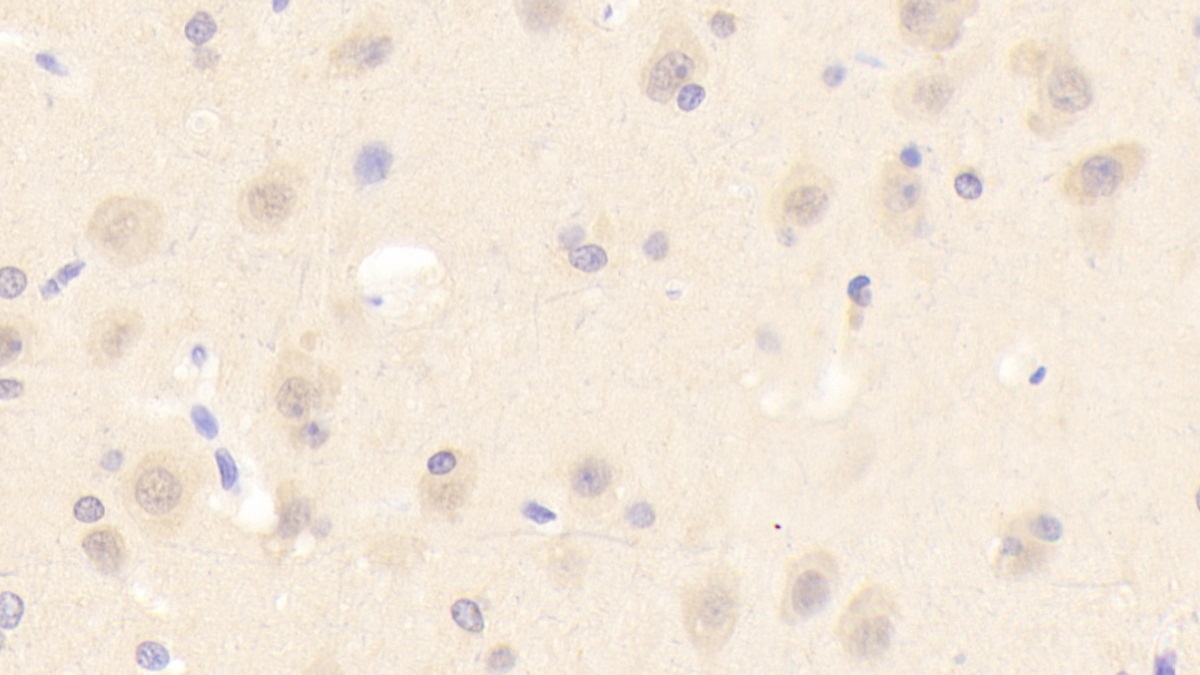 Polyclonal Antibody to Acid Sphingomyelinase (ASM)