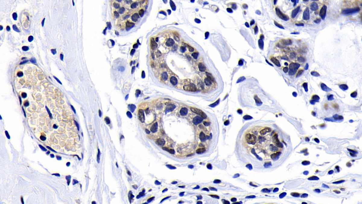 Polyclonal Antibody to Ataxia Telangiectasia Mutated (ATM)