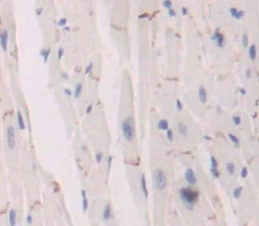 Polyclonal Antibody to Cadherin 5 (CDH5)