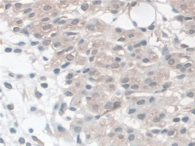 Polyclonal Antibody to Cadherin 5 (CDH5)