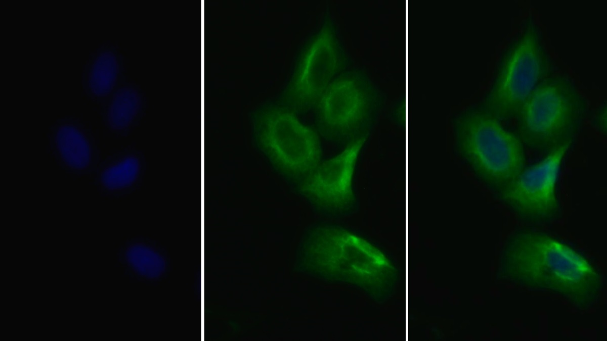 Polyclonal Antibody to Vascular Endothelial Growth Factor Receptor 2 (VEGFR2)