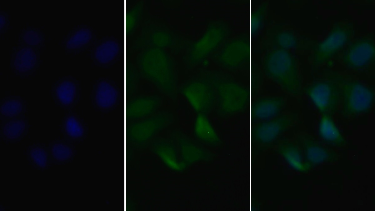 Polyclonal Antibody to Vascular Endothelial Growth Factor Receptor 2 (VEGFR2)