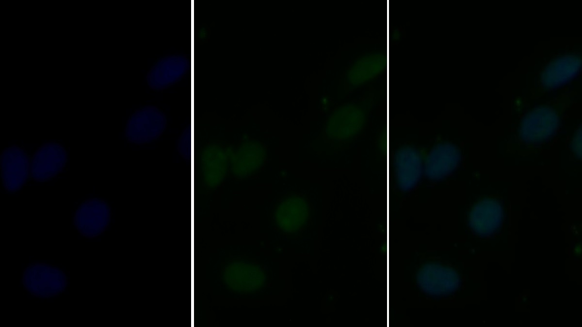 Polyclonal Antibody to Vascular Endothelial Growth Factor Receptor 2 (VEGFR2)