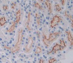 Polyclonal Antibody to Vascular Endothelial Growth Factor Receptor 2 (VEGFR2)