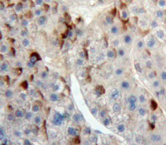 Polyclonal Antibody to Immune Receptor Expressed On Myeloid Cells 1 (IREM1)