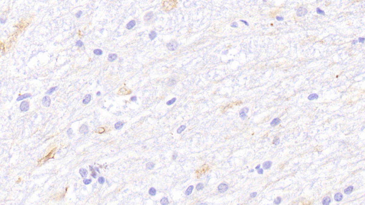 Polyclonal Antibody to Protein Kinase C Zeta (PKCz)