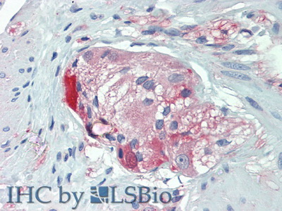 Polyclonal Antibody to Anoctamin 1 (ANO1)