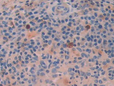 Polyclonal Antibody to Activating Transcription Factor 4 (ATF4)