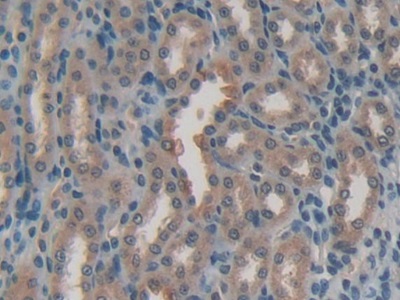 Polyclonal Antibody to Activating Transcription Factor 4 (ATF4)