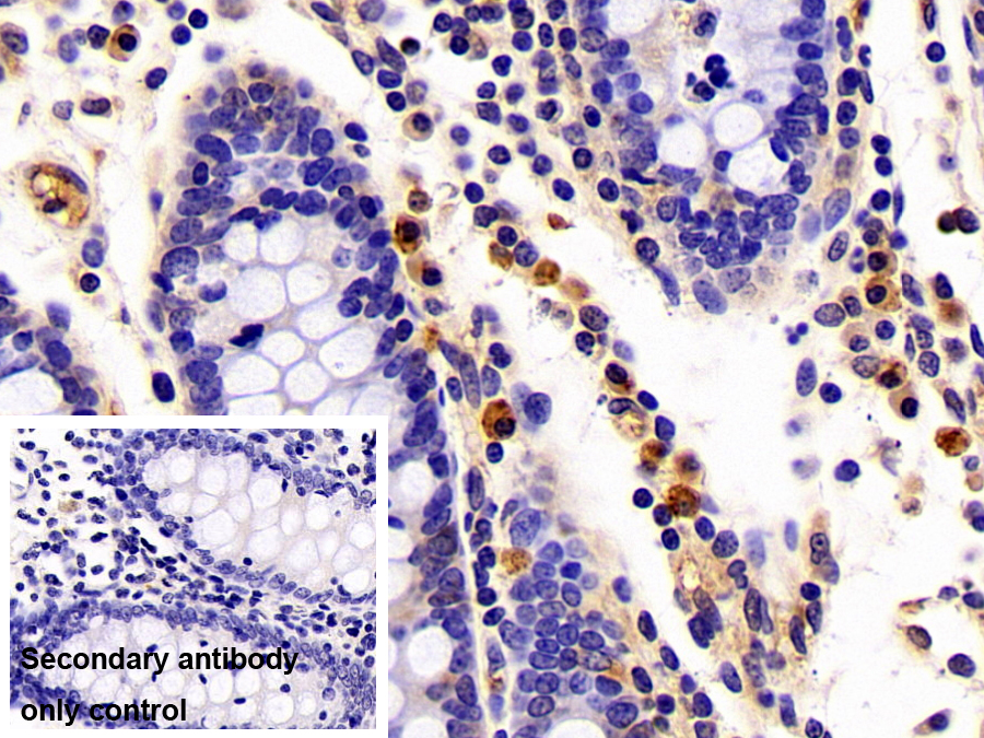 Polyclonal Antibody to Neutrophil gelatinase-associated lipocalin (NGAL)