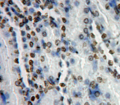 Polyclonal Antibody to Activating Transcription Factor 7 (ATF7)