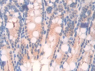 Polyclonal Antibody to Activating Transcription Factor 7 (ATF7)