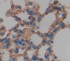 Polyclonal Antibody to Leukocyte Immunoglobulin Like Receptor Subfamily B, Member 4 (LILRB4)