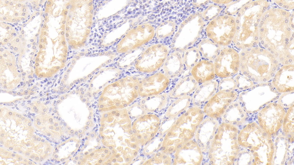 Polyclonal Antibody to Protocadherin Beta 2 (PCDHb2)