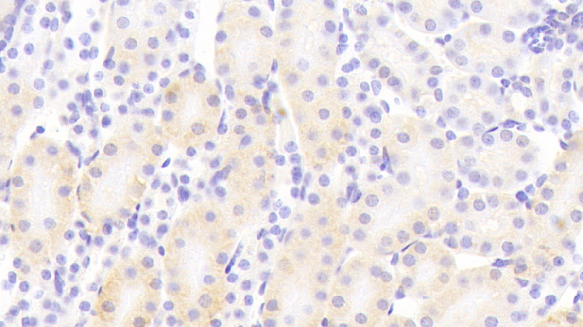 Polyclonal Antibody to Protocadherin Beta 2 (PCDHb2)