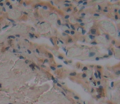 Polyclonal Antibody to Fc Fragment Of IgA Receptor (FcaR)