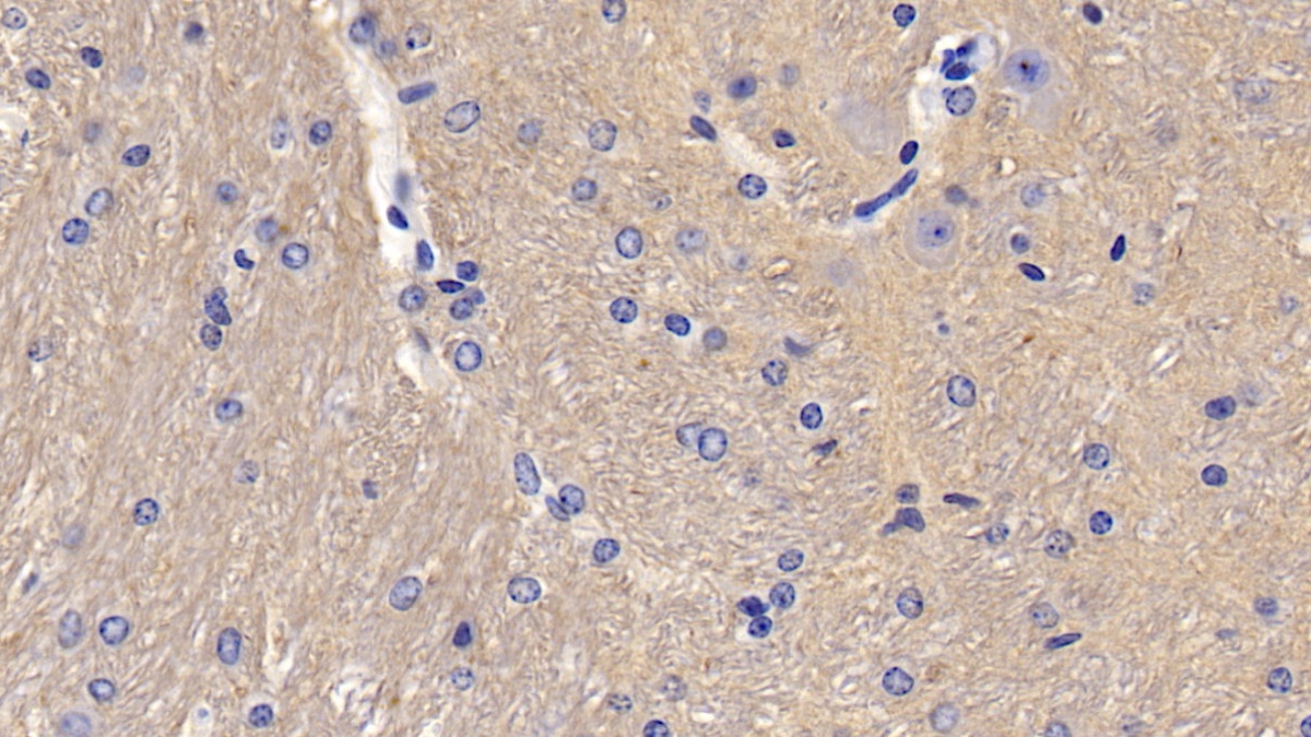 Polyclonal Antibody to Cluster of Differentiation 90 (CD90)