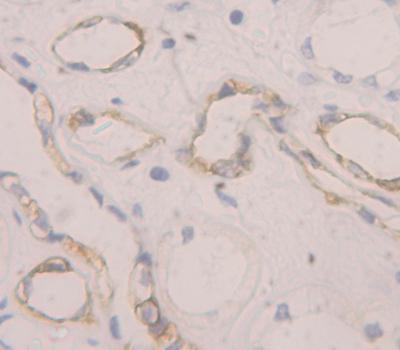 Polyclonal Antibody to Complement Component 1, Q Receptor (C1qR1)