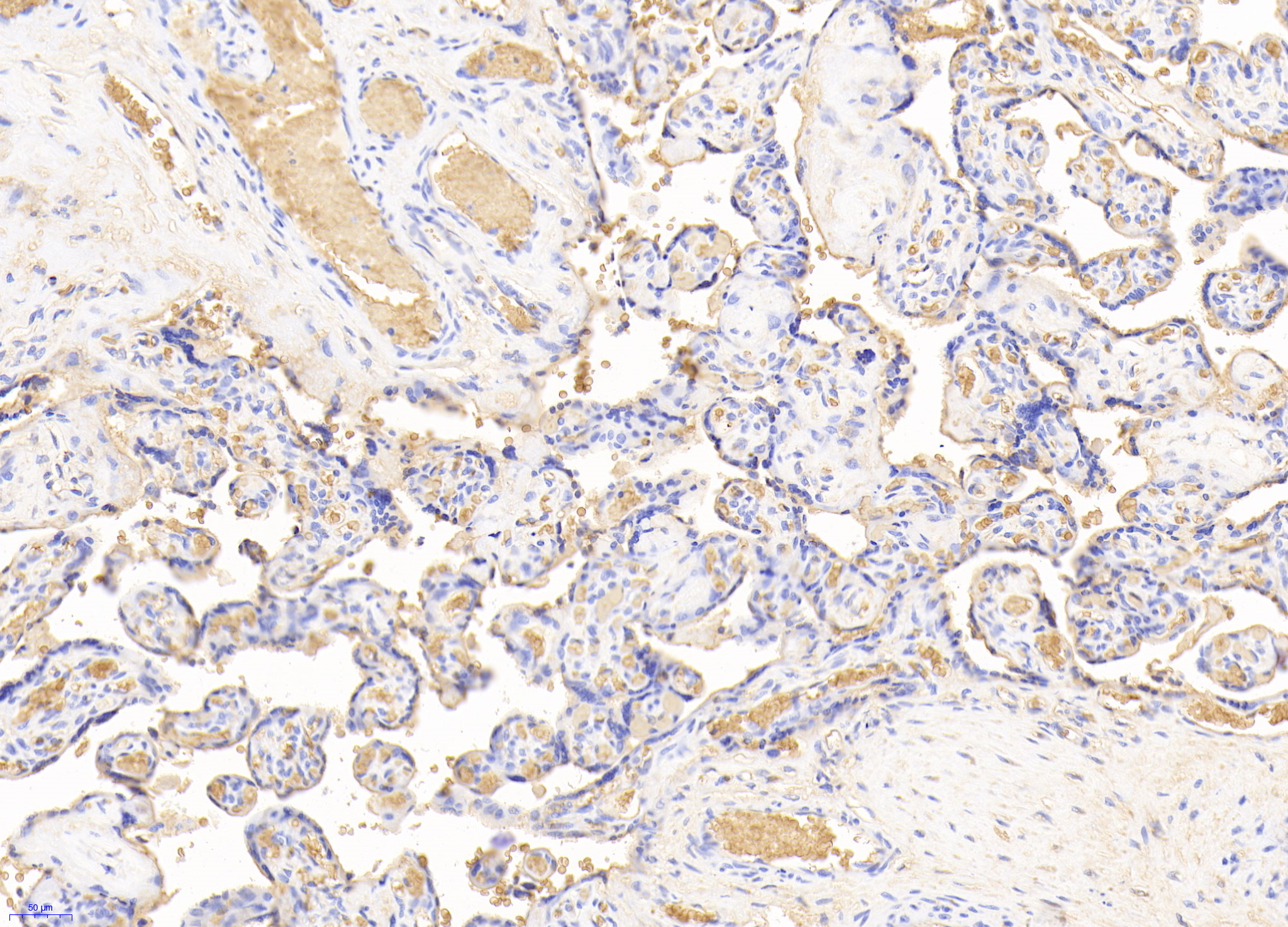 Polyclonal Antibody to Hemoglobin (HB)