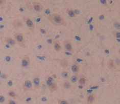 Polyclonal Antibody to Glucuronidase Beta (GUSb)