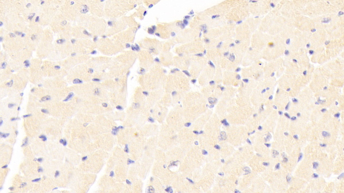 Polyclonal Antibody to Adenylate Cyclase 7 (ADCY7)